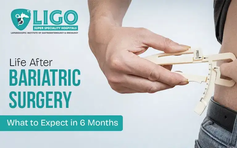 Life after bariatric surgery changes in the first six months
